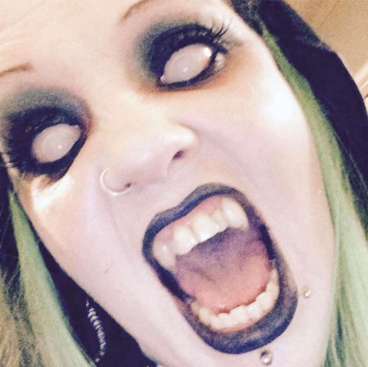 Condon thú nhận, cô bị thiếu máu do thường xuyên phải gặm mình, cô cũng bị viêm da trong hơn 20 năm và thường không đi ra ngoài trời.