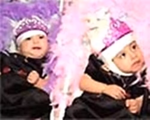 Đã có những trường hợp được tách rời như 2 chị em người Guatemala Laria Teresa và Maria de Jesus Quiej Alvarez, sinh năm 2000, dính nhau phần đỉnh đầu. Maria de Jesus đang dần hồi phục nhưng các bác sĩ vẫn phải theo dõi sức khỏe, đặc biệt là khả năng nhiễm trùng não, còn Laria Teresa qua đời sau đó.