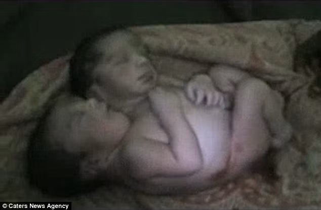 Thế nhưng, cha mẹ em vẫn hy vọng có một phép màu xảy ra bởi trông bé có sức khỏe khá tốt. Chỉ vài giờ sau, mọi chuyện xấu đi khi bé không thể ăn và khó thở. Bác sỹ đã rất cố gắng nhưng cậu bé xấu số chỉ chống chọi được trong 30 giờ đồng hồ.