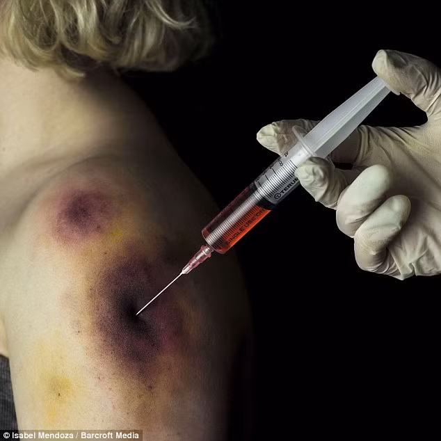 Chứng sợ tiêm chủng vaccinophobia. Chứng sợ hãi này có thể dẫn đến các phản ứng sinh lý nghiêm trọng như tụt huyết áp, ngất xỉu… Trong một vài trường hợp, khi chứng bệnh này trở nên nặng hơn có thể khiến bệnh nhân né tránh mọi vấn đề liên quan đến chăm sóc sức khỏe.