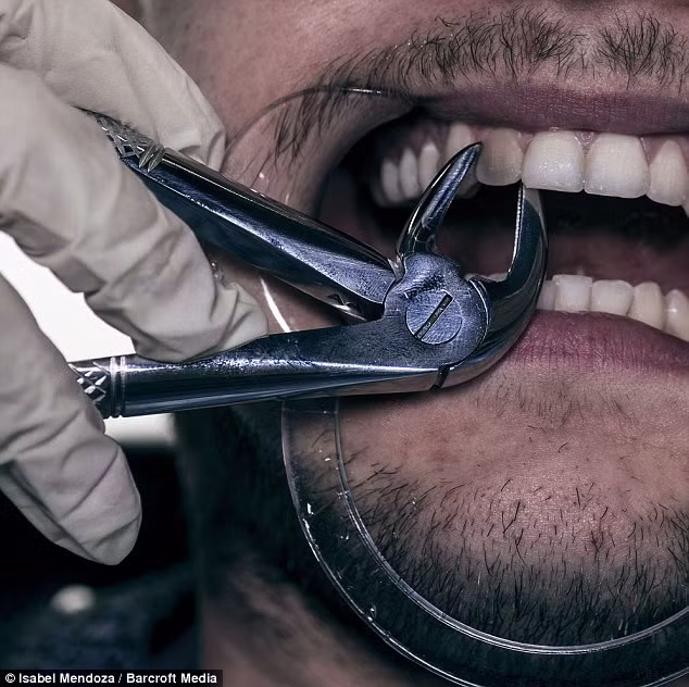 Dentophobia. Là nỗi sợ hãi nha sỹ. Khoảng 12% trong chúng ta bị lo âu nha khoa cực đoan, theo Hiệp hội Nha khoa Anh.