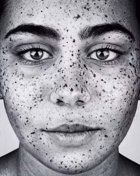 Ông đã chụp được đến 90 khuôn mặt tàn nhang và hy vọng sẽ đạt được tổng số 150 bức ảnh để trưng bày tại phòng triển lãm Michael Reid ở Sydney và Berlin vào năm 2017.