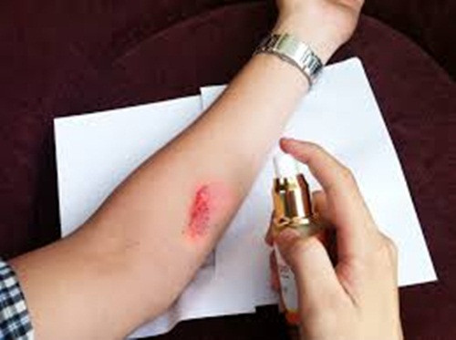 Lành vết thương chậm hơn. Để làm lành vết thương, da phải trải qua một quá trình dài: Đầu tiên, khi có cục máu đông thì tế bào máu trắng phải xông vào và làm sạch vết thương sau đó các mô sẽ được xây dựng lại. Thế nhưng, khi già đi, một số giai đoạn bị trì hoãn vì da mỏng và mạch máu cũng không nhiều chất dinh dưỡng như trước đây.