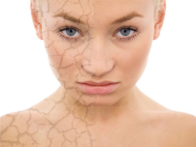 Da trở nên khô. Nhiều người có tuổi da bắt đầu kho và loang lổ. Nguyên nhân đến nhiều nguồn khác nhau, từ tiếp xúc với ánh nắng mặt trời, hút thuốc, căng thẳng quá mức, mất mồ hôi và tuyến dầu quan trọng.