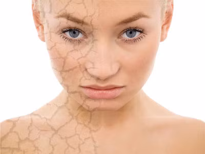 Da trở nên khô. Nhiều người có tuổi da bắt đầu kho và loang lổ. Nguyên nhân đến nhiều nguồn khác nhau, từ tiếp xúc với ánh nắng mặt trời, hút thuốc, căng thẳng quá mức, mất mồ hôi và tuyến dầu quan trọng.