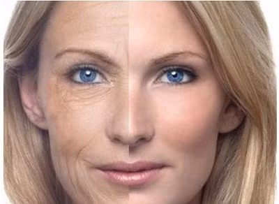 Nếp nhăn nhiều hơn. Độ ẩm sẽ tỷ lệ nghịch với tuổi tác, đóng góp vào các đường nhăn trên khuôn mặt. Ngoài ra, lão hóa cũng dẫn đến việc sụt giảm chất béo trên khuôn mặt tạo thành các đường rãnh là nếp nhăn.