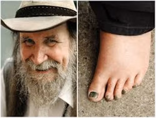 Và ông Peter Mckenzei cũng đã nổi tiếng vì đã rũ bỏ thói quen dày dép trong gần 50 năm.