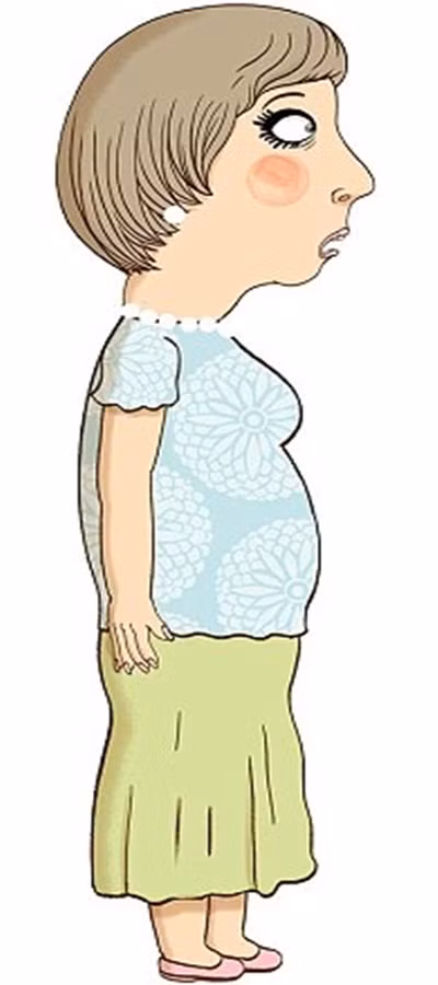 Bụng to do tuyến giáp. Không chỉ béo ở phần bụng mà còn bị béo phần chân, tay và các vùng khác. Nguyên nhân có thể là việc sản xuất hormone thyroxine bị rối loạn khiến cho việc xử lý calo vào cơ thể cũng rối loạn theo.