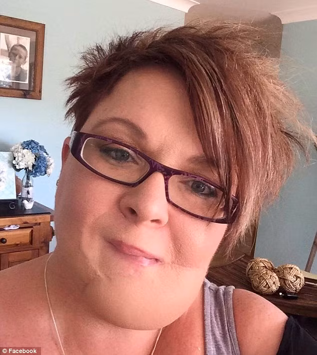 Đây là một dạng ung thư da hiếm gặp có tên dermatofibrosarcoma protuberans (DFPS), chỉ có 8 người ở Úc mắc bệnh này. Loại ung thư này nó có xúc tu dài rất dễ lây lan xung quanh và hình thành rễ sâu. DFPS không gây tử vong nhưng rất khó điều trị bởi quá trình phát triển phức tạp.