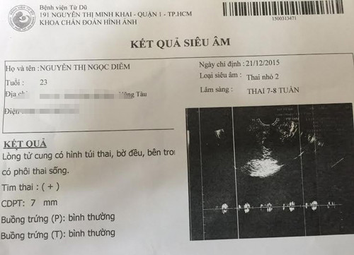 Benh vien Quan 9 len tieng viec vo chong tre “to” suyt mat con-Hinh-3