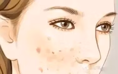 Chú ý giữ vệ sinh vùng da xung quanh vết thương hở, không được ăn những thức ăn có chất kích thích. Luôn vui vẻ lạc quan, tránh quá bị kích động, tức giận hãy buồn chán. Duy trì giấc ngủ đủ sẽ là một cách giúp vết thương hồi phục nhanh, không nên để vết thương ở tiếp xúc lâu dưới tia cực tím. Ảnh: Sohu.