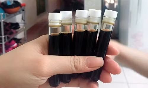 Mau luon tri mun: Phuong phap lam dep tiem an nhieu nguy hiem