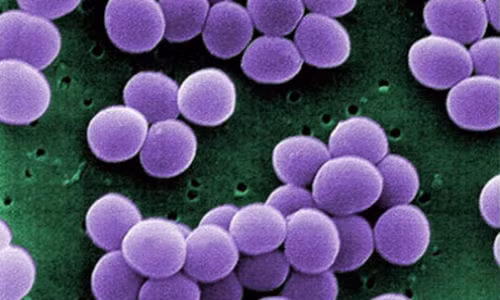 Tu cau vang: "duong kim vo dich" khang thuoc khang sinh