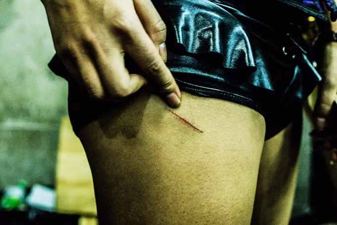 Thỉnh thoảng, các cô gái cũng gặp nỗi đau về thể xác như thế này.