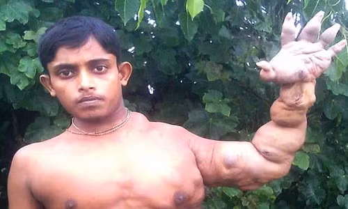 20 nam song trong so hai vi co the bien dang do mac benh hiem