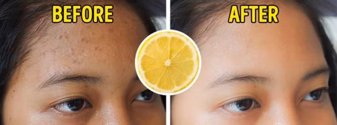 Chanh: Nước chanh được coi là chất làm se da tự nhiên, giúp ngăn ngừa tình trạng da chảy xệ và chống hình thành các vết thâm. Bên cạnh đó, vỏ chanh cũng chứa flavonoid có tác dụng bảo vệ và chống ung thư da.