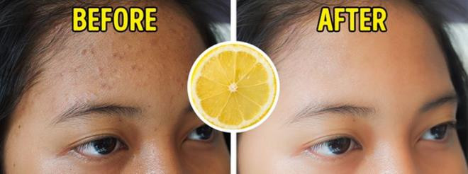 Chanh: Nước chanh được coi là chất làm se da tự nhiên, giúp ngăn ngừa tình trạng da chảy xệ và chống hình thành các vết thâm. Bên cạnh đó, vỏ chanh cũng chứa flavonoid có tác dụng bảo vệ và chống ung thư da.