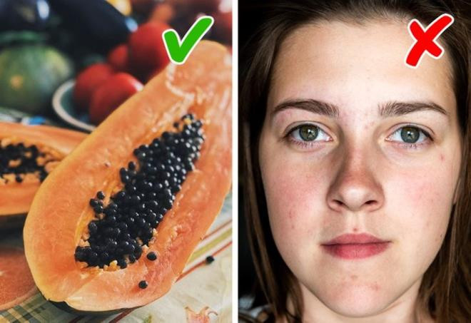 Đu đủ: Đu đủ rất giàu enzyme tiêu hóa gọi là papain giúp tẩy tế bào chết, làm thông thoáng lỗ chân lông và hỗ trợ làm mờ sẹo do mụn. Thường xuyên ăn đu đủ cũng giúp cho da của bạn luôn đủ nước và ngăn ngừa hình thành mụn.