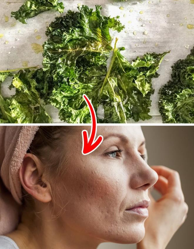 Cải xoăn: Cải xoăn rất giàu vitamin C, K và các khoáng chất khác giúp tăng sắc tố và làm đều màu da của bạn. Ngoài ra, thực phẩm này cũng có tác dụng làm giảm các vết thâm và tăng tốc độ chữa lành vết thương trên da của bạn.