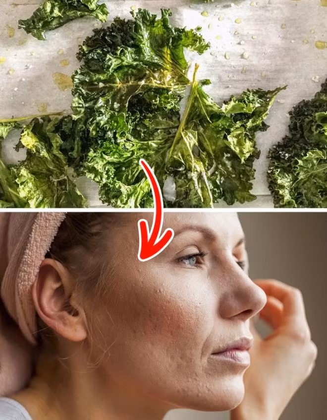 Cải xoăn: Cải xoăn rất giàu vitamin C, K và các khoáng chất khác giúp tăng sắc tố và làm đều màu da của bạn. Ngoài ra, thực phẩm này cũng có tác dụng làm giảm các vết thâm và tăng tốc độ chữa lành vết thương trên da của bạn.