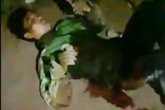 Được biết, hiện anh Q. được dẫn lưu màng phổi phải, mê, thở qua nội khí quản, da niêm mạc nhợt, sốc mất máu, vết thương ngực hở. Nhiều vết thương lưng và ngực: 1 ngực phải, 2 lưng, 1 cạnh sườn phải, 1 cẳng tay trái. Đến chiều 20/7, anh Q. đã qua được cơn nguy kịch nhất, đang dùng thuốc trợ tim liều cao. Tình trạng bệnh nhân nặng, ổn định. 