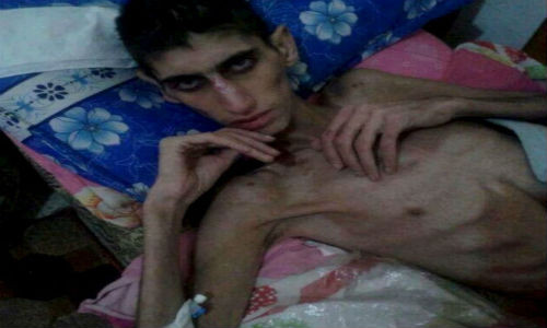 Khung hoang nhan dao o Syria qua anh-Hinh-2