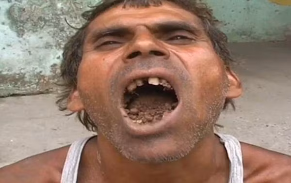 Không phải thức ăn, bùn đất và gạch vụn mới là "món tủ" của người này Khong phai thuc an, bun dat va gach vun moi la "mon tu" cua nguoi nay