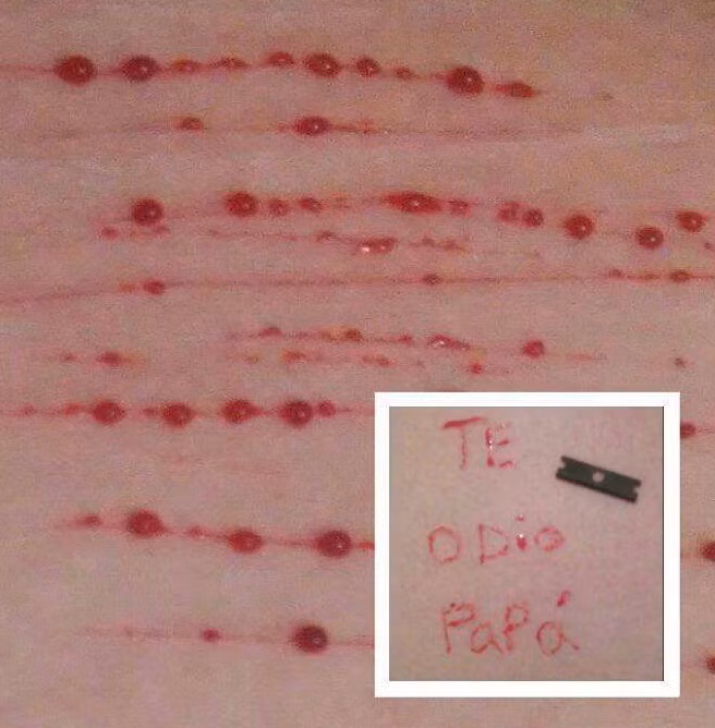 Chuyen la hom nay: Co be tu rach khap co the va noi dau phia sau-Hinh-3