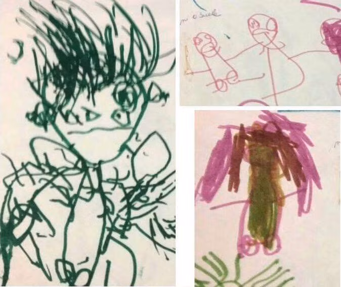 Chuyen la hom nay: Co be tu rach khap co the va noi dau phia sau-Hinh-2