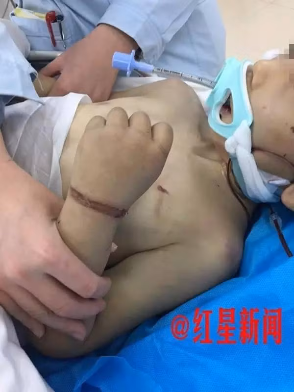 Nhìn con trai đau đớn, gần như mất hết tri giác nằm trên giường bệnh, mẹ ruột của Bằng Bằng khổ sở khôn cùng, trái tim cô như bị ai bóp nghẹn. Thế nhưng tất cả mọi khao khát có thể chịu thay đau đớn cho con trai của cô không thể thành hiện thực. Hối hận vì đã không đi tìm con sớm hơn, người mẹ rơi nước mắt không ngừng vì bất lực. (Nguồn Sina)