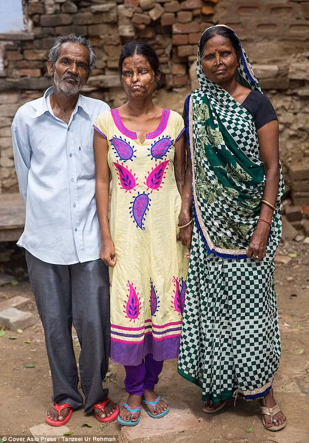 Nhắc đến nỗi đau, cô Geeta cho biết, bởi vì cô chỉ sinh được 3 người con gái, không sinh được con trai, nên chồng cô luôn luôn bất mãn. Thường ngày, để đe dọa vợ mình, ông Inderjeet hay la hét: "Ít gây chuyện với tôi đi, bằng không sẽ có ngay tôi hủy hoại khuôn mặt cô đấy!". Chẳng ai ngờ, vào một buổi tối muộn, ông Inderjeet thực sự xuống tay tàn nhẫn, hắt axit vào mặt vợ và con gái mình. (Nguồn Youthwant)