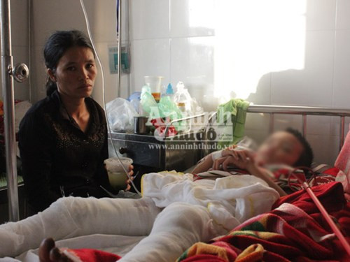 Thao đại diện Công an xã Lĩnh Sơn, hoàn cảnh cháu Vinh khá đáng thương. Người cha châm lửa đốt cháu hiện thần kinh không ổn định sau vụ tai nạn cách đây 2 năm. Mẹ cháu đi làm xa ở miền Nam, bà nội thì hơi mát tính.