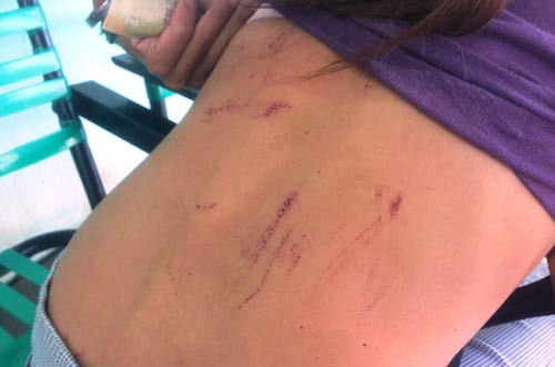 Noi kinh hoang cua nguoi ban ve so bi lam nhuc-Hinh-3