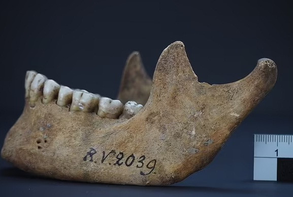 Cụ thể, các nhà khoa học phát hiện vi khuẩn Yersinia pestis có trong bộ hài cốt của một nam giới có niên đại 5.000 tuổi.