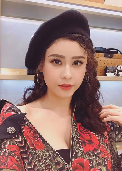 Trước khi thực hiện loạt phẫu thuật thẩm mỹ, Trương Quỳnh Anh đã hỏi ý kiến của chồng và anh hoàn toàn đồng ý.