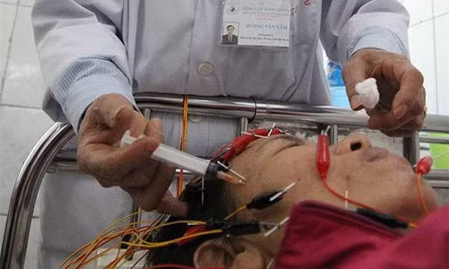 Bác sĩ Dương Văn Tâm trị méo mặt cho bệnh nhân bằng điện châm, thủy châm.