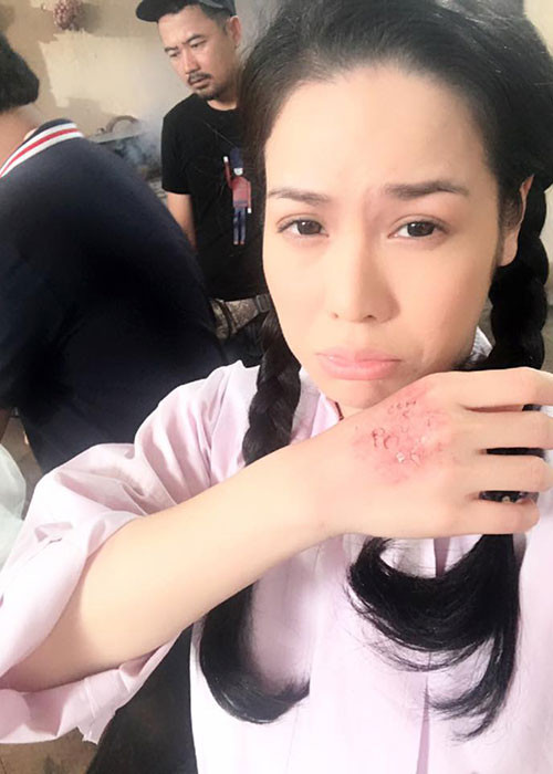 Nhật Kim Anh chia sẻ hình ảnh bàn tay được hóa trang thành bị thương để phục vụ việc quay phim.