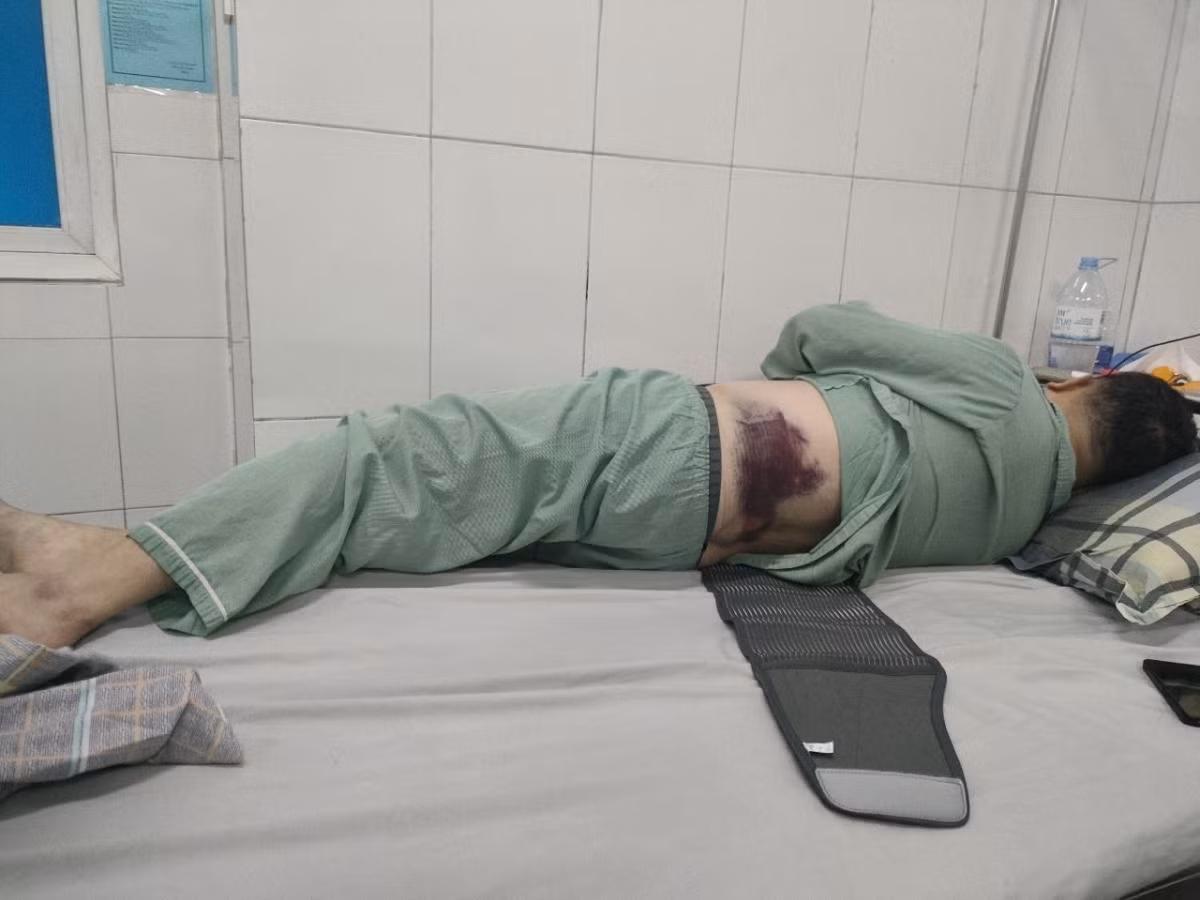 Đỗ xe trên vỉa hè, người đàn ông bị đánh nhập viện Do xe tren via he, nguoi dan ong bi danh nhap vien