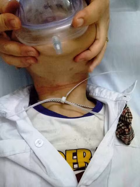 Be trai 3 tuoi suyt bi that co den chet vi lay thu nay lam vong co-Hinh-2