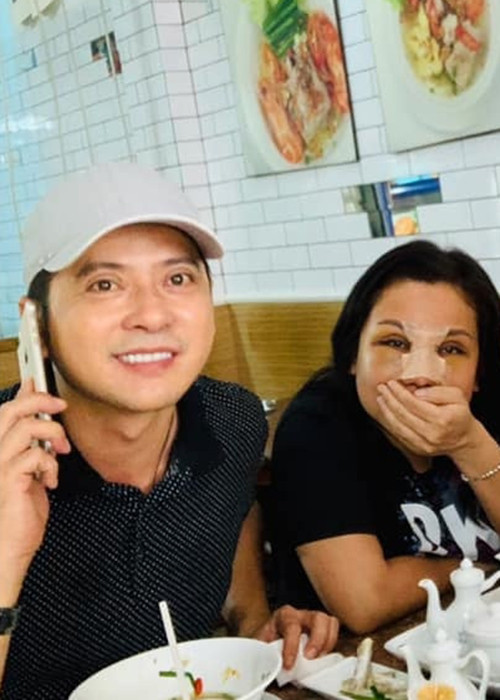 Năm 2019, khi về Việt Nam, Quỳnh Như làm răng sứ đồng thời phẫu thuật thẩm mỹ mũi.