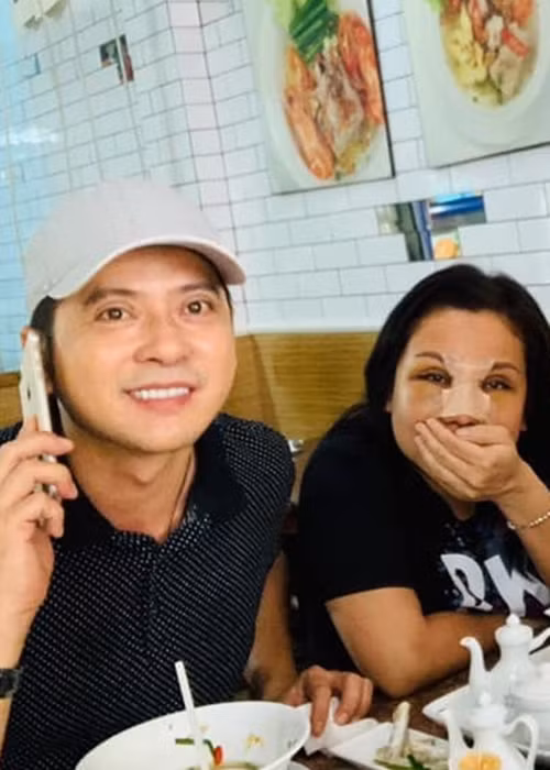 Năm 2019, khi về Việt Nam, Quỳnh Như làm răng sứ đồng thời phẫu thuật thẩm mỹ mũi.