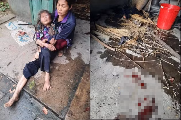 Nam thanh nien thieu cu ba 90 tuoi de cuop tien