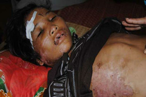 Tháng 5/2010 (khoảng 2 năm sau) Hào Anh được giải cứu khỏi vợ chồng chủ trại tôm giống Minh Đức là Huỳnh Thanh Giang và Mã Ngọc Thơm với thương tích 70%. 