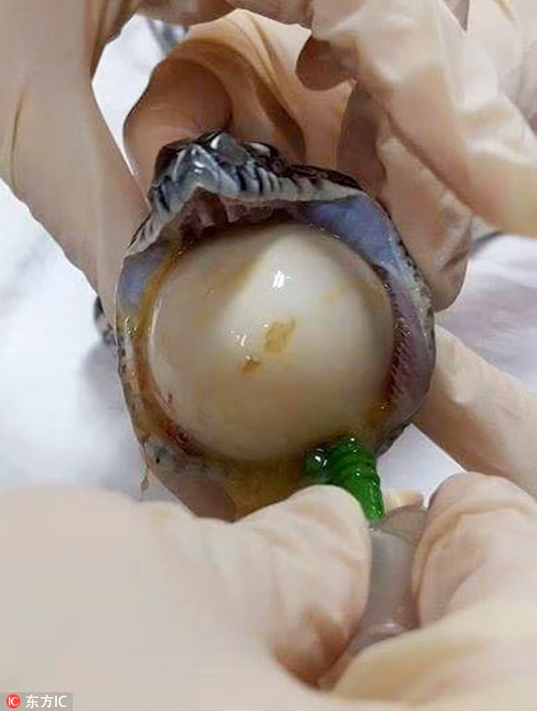 Được biết, do đói bụng, con trăn thảm phàm ăn quyết định lẻn vào chuồng gà của một hộ dân tại Brisbane và xơi tái toàn bộ số trứng gà có trong tổ. Không may, trong số trứng đó có 2 quả trứng giả làm bằng nhựa. (Nguồn Sina)