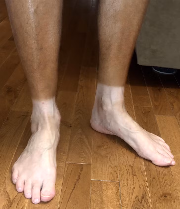 Thứ khiến đôi chân của người đàn ông này biến sắc là do sự cần cù, chăm chỉ, lao động không biết mệt mỏi suốt cả cuộc đời.