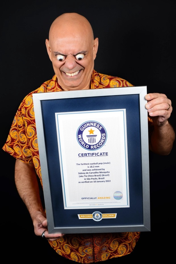 Het hon voi doi mat ky di cua nguoi dan ong Brazil