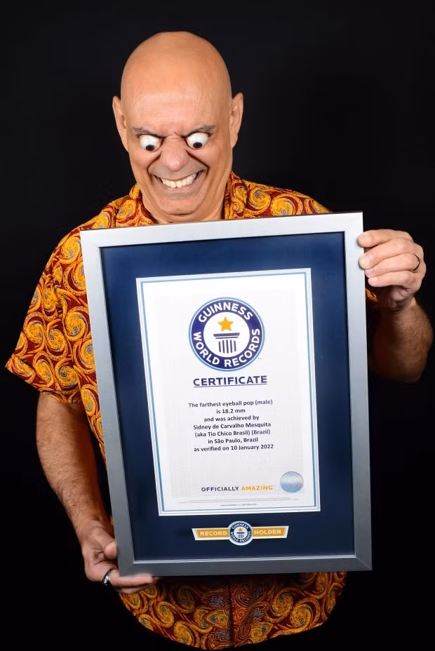 Het hon voi doi mat ky di cua nguoi dan ong Brazil