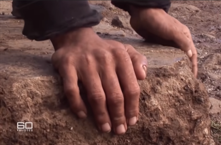 Đặc biệt, bàn tay cũng to, sần sùi và thô ráp hơn bình thường.