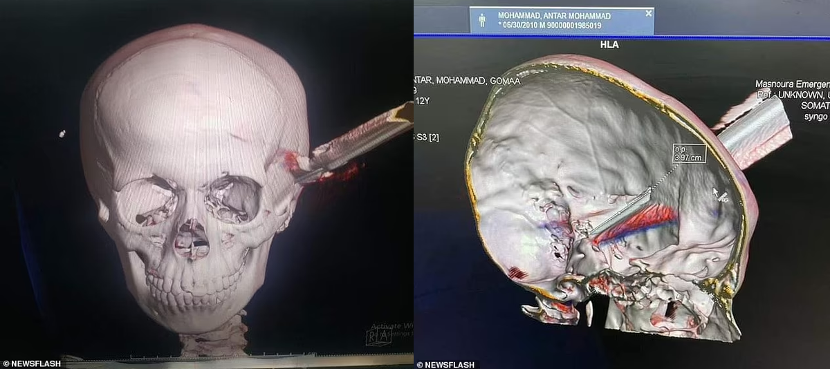 Be trai dung dua ca dam xuyen hop so ban cung lop-Hinh-2