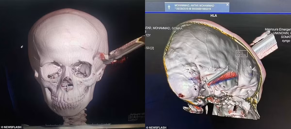 Be trai dung dua ca dam xuyen hop so ban cung lop-Hinh-2